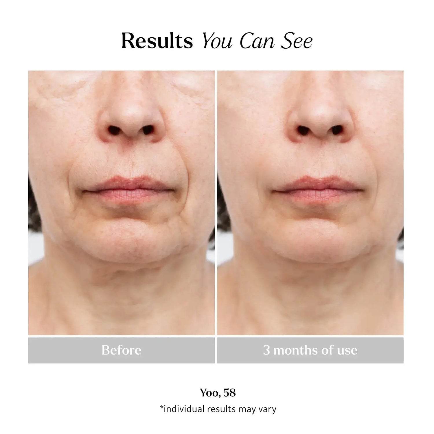 Ageless Serum Lemon &amp; Beaker