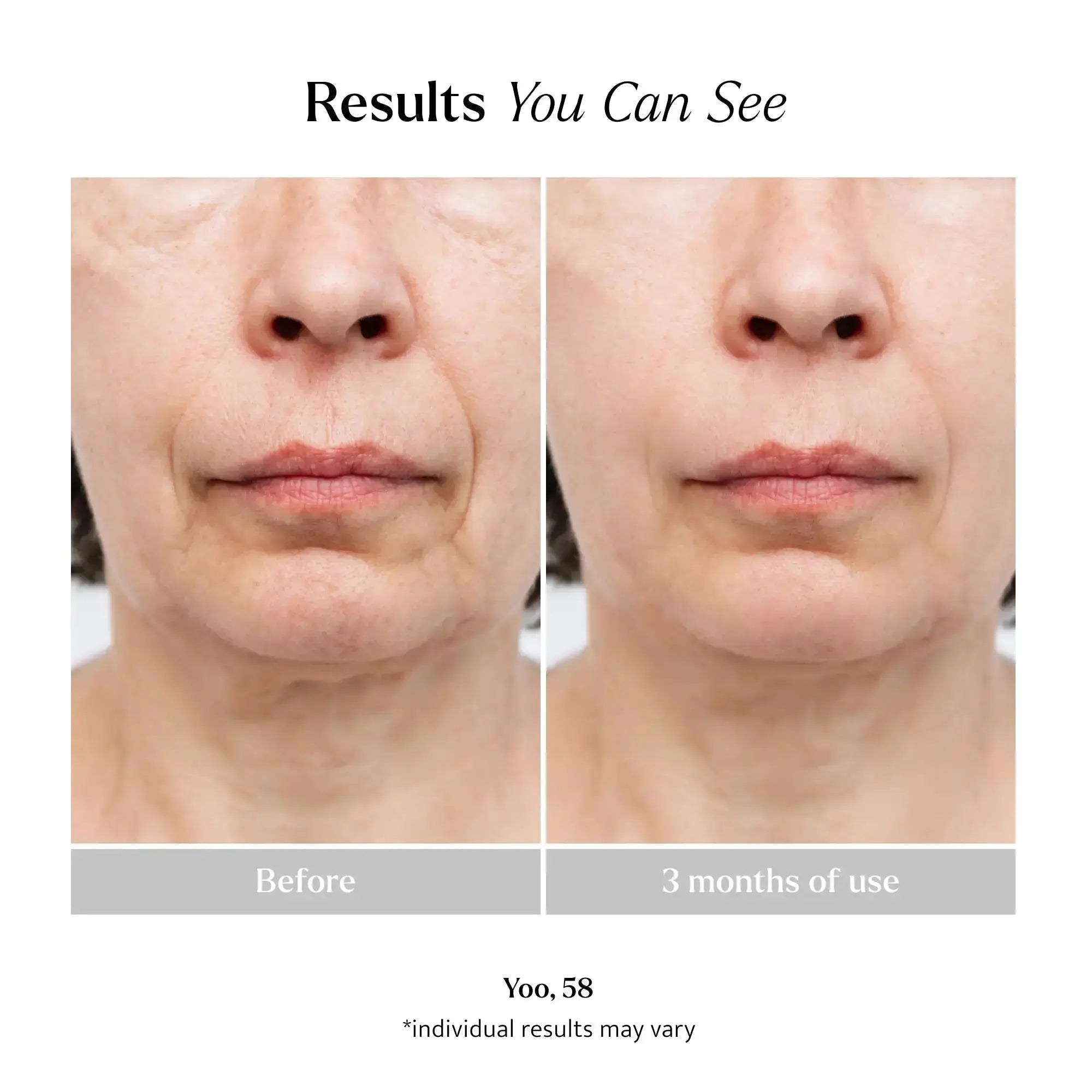 Ageless Serum Lemon &amp; Beaker